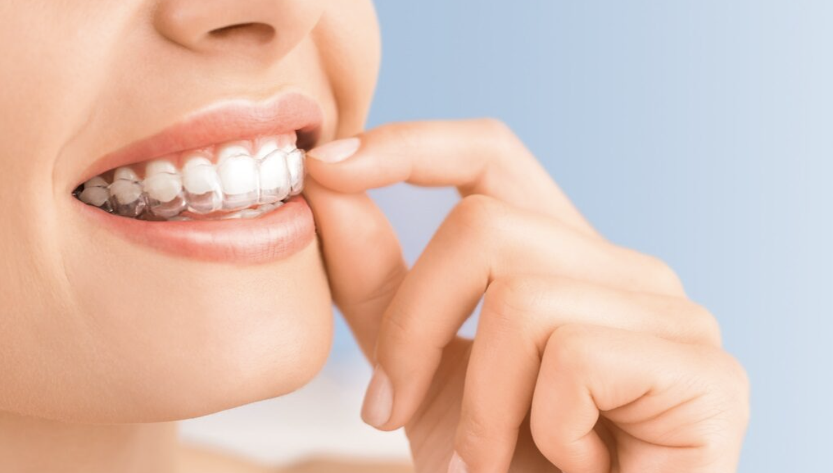 Has Orthodontic Treatment Ended? Learn How to Self-Assess!