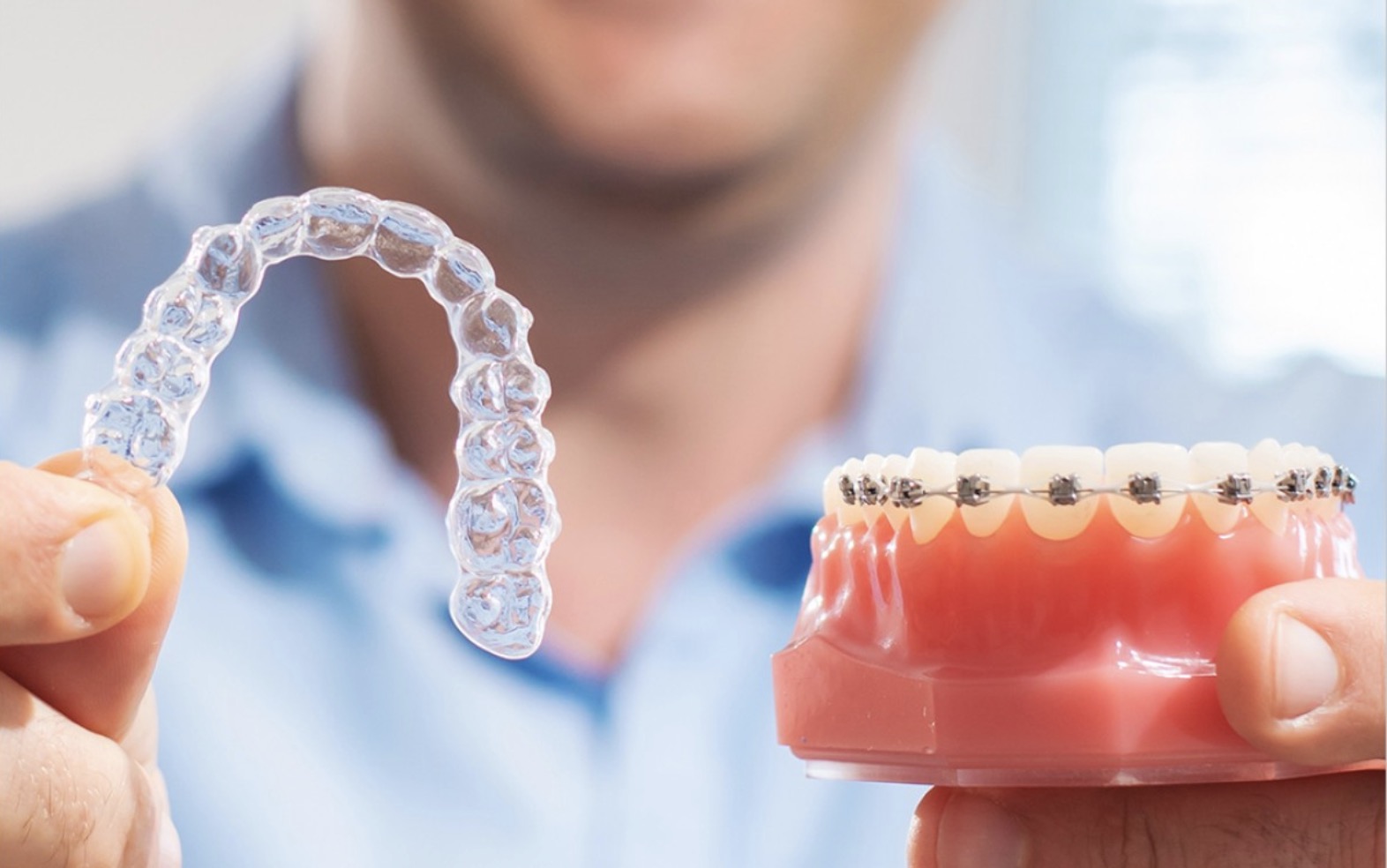 The Surge in Clear Aligners: Unveiling the Soaring Demand for Invisible Orthodontic Solutions
